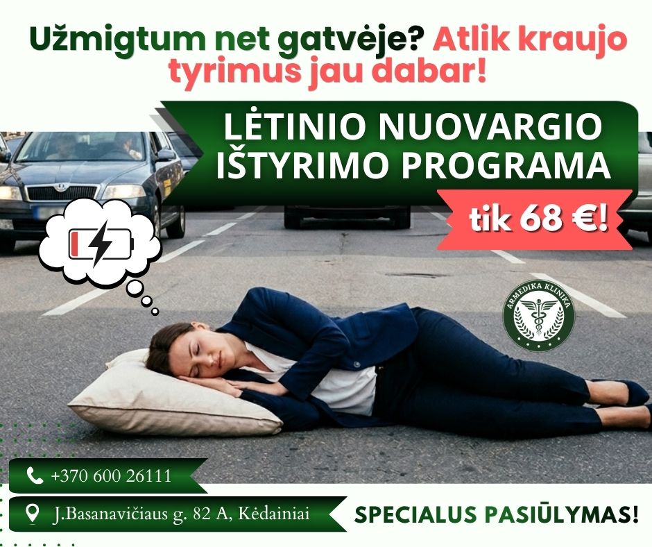 Jautiesi taip, tarsi galėtum užmigti bet kur ir bet kada?